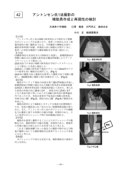 アントンセン氏1法撮影の 補助具作成と再現性の検討 42