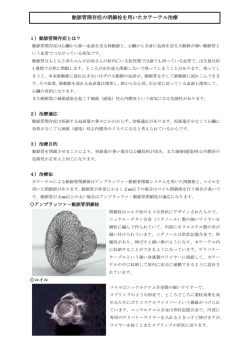 動脈管開存症の閉鎖栓を用いたカテーテル治療
