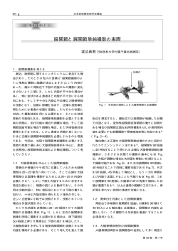 股関節と肩関節単純撮影の実際 - MT Pro
