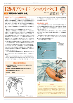 肩関節症の症状と治療 - 森田シャントアミロイド治療クリニック