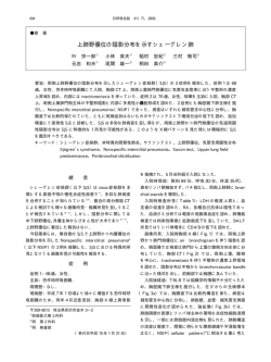 上肺野優位の陰影分布を示すシェーグレン肺 - 日本呼吸器学会