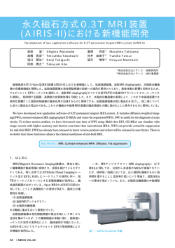 永久磁石方式0.3T MRI装置(AIRIS-II)における新機能開発 - 日立メディコ
