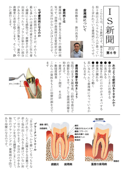 I S 新 聞