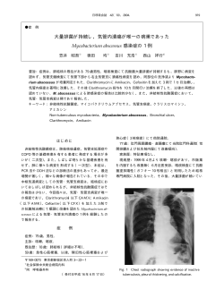 気管内潰瘍が唯一の病巣であった Mycobacterium  - 日本呼吸器学会