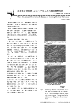 走査電子顕微鏡によるミクロ三次元構造観察技術