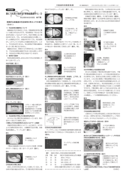 誰にでも取り組める「明快総義歯作り」③ - 大阪府歯科保険医協会
