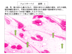 フォトサーベイ