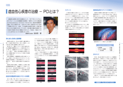虚血性心疾患の治療 &minus; PCIとは？ - 製鉄記念八幡病院