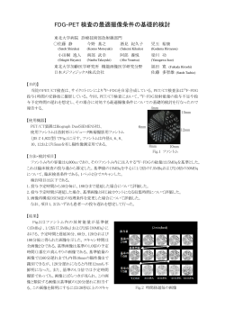 FDG-PET 検査の最適撮像条件の基礎的検討 - 日本放射線技術学会
