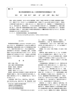 孤立性結節陰影を呈した肺好酸球性肉芽腫症の 1 例 - 日本呼吸器学会