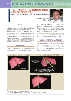 1．[CT]肝臓をMDCTで探る