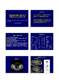 下腹部痛を契機に発見された 骨盤内Castleman病の1例 はじめに