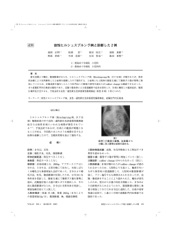 仮性ヒルシュスプルング病と診断した2例 - 徳島赤十字病院