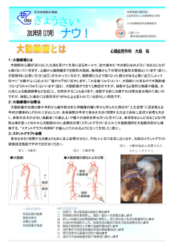 1：大動脈瘤とは 2：大動脈瘤の治療法 3：ステントグラフト治療