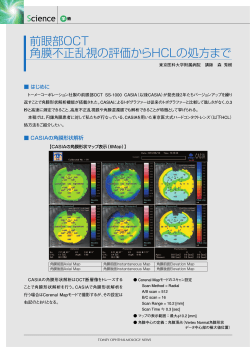 前眼部OCT 角膜不正乱視の評価からHCLの処方まで - TOMEY