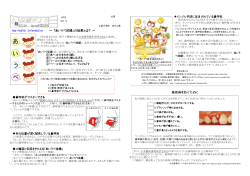 「「あいうべ体操」の効果とは 歯周病を ぐために - onomichi.ed.jp