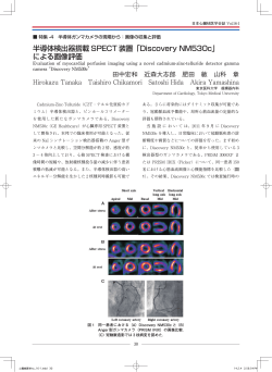 半導体検出器搭載 SPECT 装置「Discovery - 日本心臓核医学会