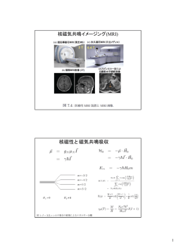核磁気共鳴イメージング(MRI)