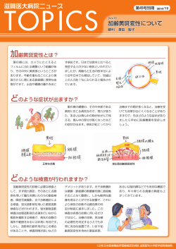 加齢黄斑変性について(PDF 1927k) - 滋賀医科大学
