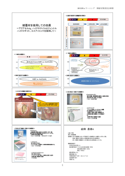 被覆材を使用しての効果