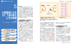心筋虚血による ST，T波の変化 とその特徴