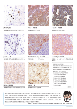 Ki-67 脳 CK7 肺腺癌 CK20 大腸癌 TTF-1 肺 CK（AE1 - R