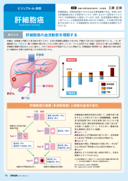 肝細胞癌の血流動態を理解する