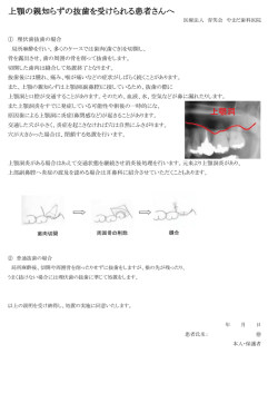 上顎の親知らずの抜歯を受けられる患者さんへ 上顎洞
