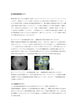 蛍光眼底造影検査とは？ 眼科疾患に用いられる造影剤（色素）には