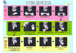 GT剤を手に乗せる 1. GT剤を両手で持つ 2. 凹部に親指を当て 3. GT剤を