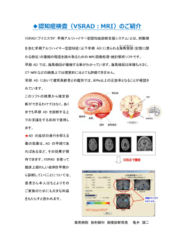 認知症検査（VSRAD：MRI）のご紹介