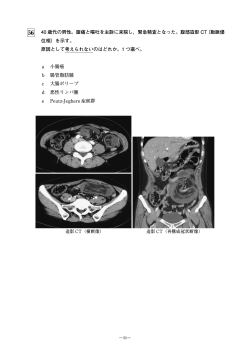 2014年 第23回放射線診断専門医試験問題P.53～65