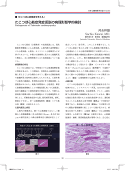 たこつぼ心筋症発症仮説の病理形態学的検討