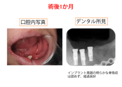 術後 か月