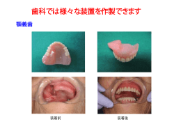歯科では様々な装置を作製できます
