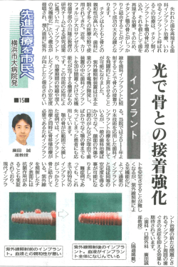 記事の拡大;pdf