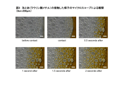 図3 泡と油（ラウリン酸メチル）の接触した様子のマイクロスコープ;pdf