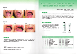 ホエイタンパク、EGF配合保湿剤を使用した口腔ケアの効果;pdf