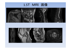 1.5T MRI 画像