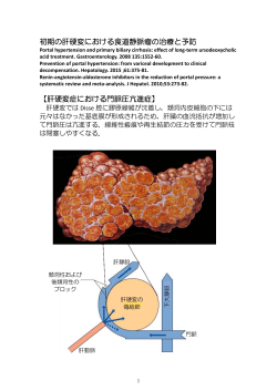 初期の肝硬変における食道静脈瘤の治療と予防 【肝硬変症における門脈