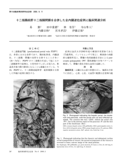 十二指腸前肝十二指腸間膜を合併した全内臓逆位