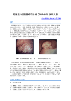 経尿道的膀胱腫瘍切除術（TUR-BT）説明文書