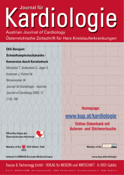 EKG-Beispiel: Schmalkomplextachykardie