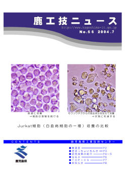 Jurkat細胞（白血病細胞の一種）培養の比較