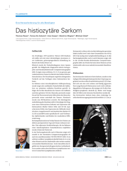 Das histiozytäre Sarkom