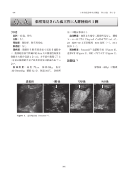 偶然発見された孤立性巨大脾腫瘤の 1 例