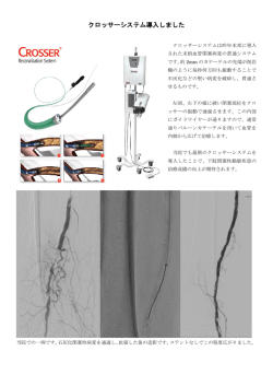 クロッサーシステム導入しました