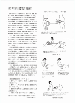 変形性膝関節症 - 内田クリニック