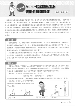 医学の豆知識 変形性膝関節症