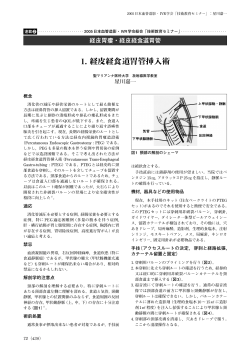 経皮胃瘻・経皮経食道胃管